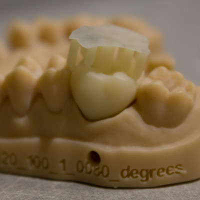 3D печать в стоматологии. Киев