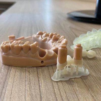 Онлайн курс: "Высокоточная 3D печать в стоматологии"